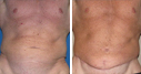 Before & After Photos
